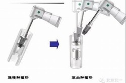 "韩国Dentium口腔种植系统：您的高端口腔健康解决方案"