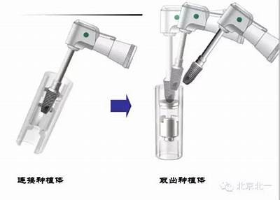 "韩国Dentium口腔种植系统：您的高端口腔健康解决方案"